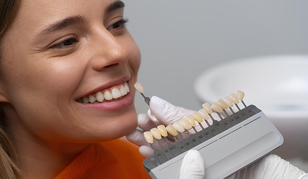 5 Benefits of Porcelain Veneers You Didn’t Know
