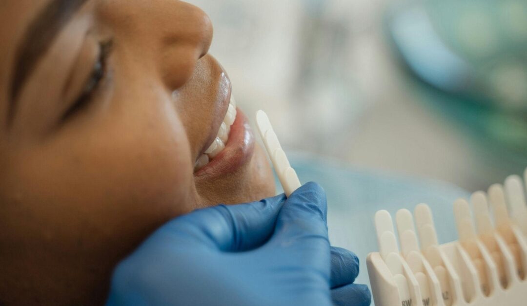 Dentist comparing teeth shade colors during a whitening consultation
