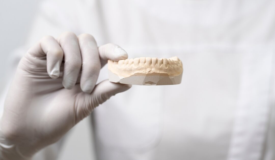 Dentist holding dental model to examine loose dental implant placement and stability